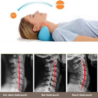 50% KORTING | NeckRelax™ - Chiropractische neksteun en massageapparaat [Laatste dag korting]